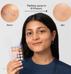 Gush Beauty Skin Play Dart It Acne Patches