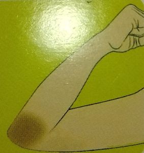 Nigrifix Cream