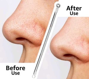 Stainless Steel Blackhead Remover Tool