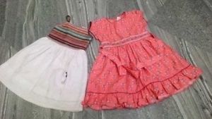Babygirl casual dress