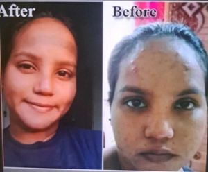 Get Fair Skin In 30 Days