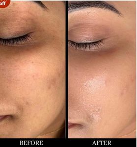 Ayurveda Face Cream - Glow, Hydrate