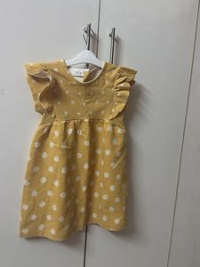 casual frock