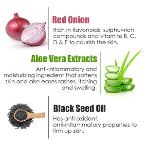 WOW Red Onion Black Seed Oil Skin Mist Toner