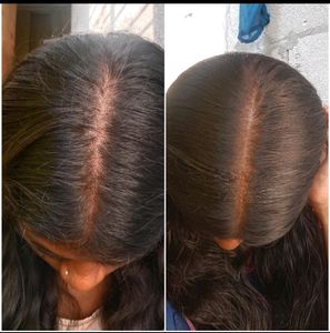 Homemade Secret Herbal Hairgrowth Oil
