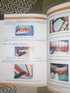 Preclinical Manual of Prosthodontics Textbook