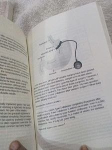 The Diabetes Code by Dr. Jason Fung