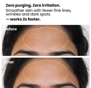 Foxtale Retinol Night Serum