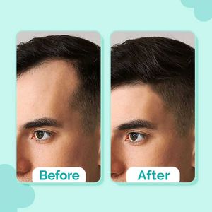 The Derma Co. Peptide-Stem Cell Hair Growth Serum