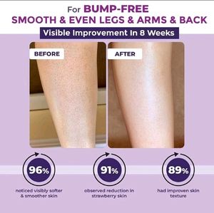 Sealed Sanfe Bumps Erasing Body scrub