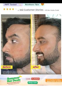 Plix Pineapple De-Pigmentation Dewy Serum