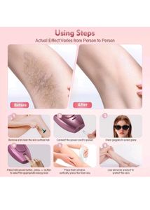 IPL Hair Remover ✨️🪒