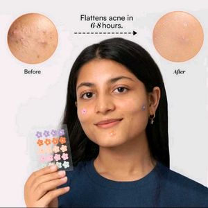 Gush Dart It Acne Patches