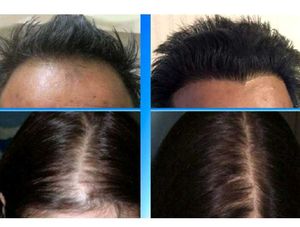 Spell Effect Hair Growth Serum &amp; Soap