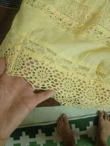 Chic Lace Trimmed Yellow Dress