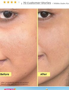 MRP- 425 ( plix Pineapple Exfoliation Fruity Toner