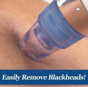 Black Head Remover Vacuum Suction Device