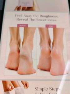 Seoulskin Glycolic Acid Foot Mask