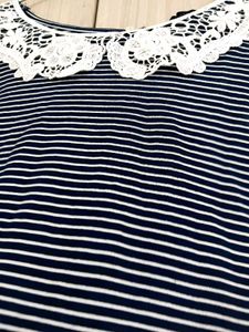 Striped Top with Lace Collar