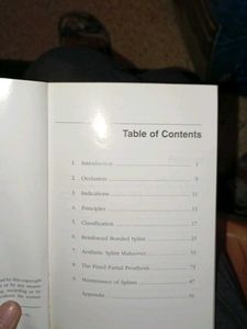 Splinting Management of teeth dental  MDS book