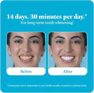Perfora Teeth Whitening Strips - Classic Mint