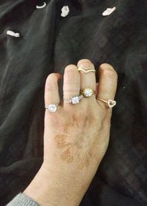 Assorted Ring Set
