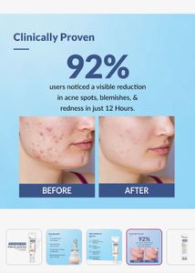 Fixderma Salicylic Acid Acne Spot Corrector