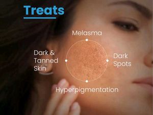 Fixderma AHA Lightening Gel HQ