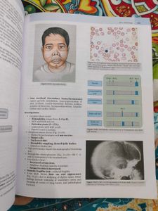 Arun Babu Pediatrics Mbbs Book