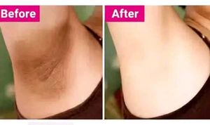 under arm whitening roll on