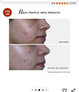 Novology Acne Rescue Spot Corrector
