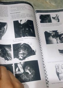 Odontogenic Tumours Textbook Chapter