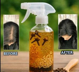 Homemade Hair Growth &amp; Volume Spray 🧖