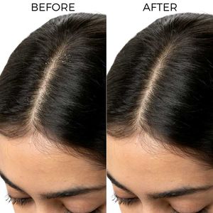 pack of 2, Lactylate Shampoo