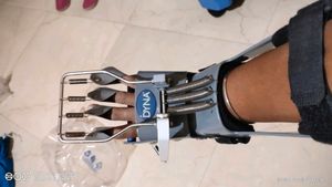 Dynamic Cock Up Splint (Finger Extension Assist)