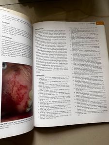 malamed Handbook of Local Anesthesia