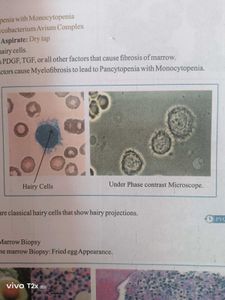 Structured Notes Pathology - Dr. Preeti Sharma