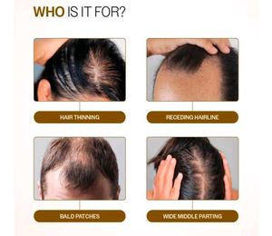 3 Bare Anatomy Advanced Hair Growth Serum Roll-On