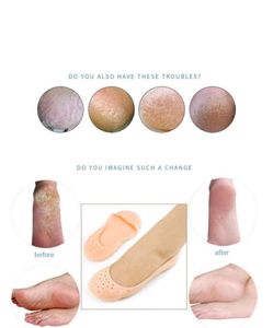 New Silicon Socks To Keep Your Feet Crack Free