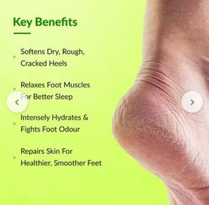 Fixderma Foot Roll On