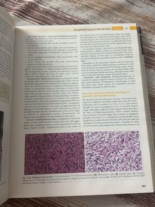 Shafer's Textbook of Oral Pathology