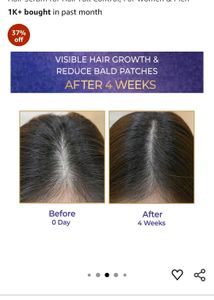 Streax Vita Growth Hair Serum - 30ml