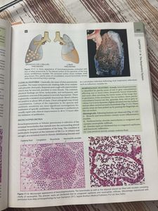 Textbook of Pathology 8th Edition