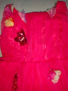 1-2 Baby Girl Frock 💞