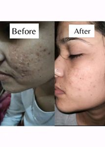 Skin Whitening Cream