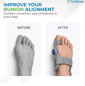 Bunion Corrector Splint Brace pain relief