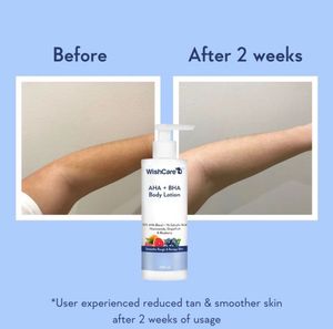 WishCare Body Lotion for bummy skin