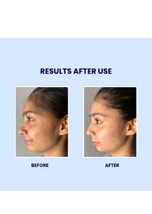 SUROSKIE Gluta Boost Face Wash