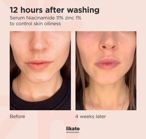 Likato Professional Niacinamide &amp; Zinc Serum