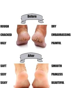New Silicon Socks To Keep Your Feet Crack Free